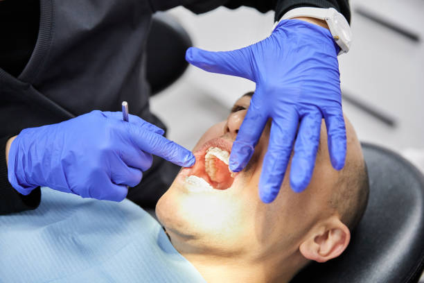Best Emergency Dentist for Lost Fillings or Crowns in Snow Hill, NC